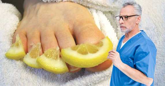 Знищити грибок нігтів за 14 днів можливо! У складі лимона присутні речовини …